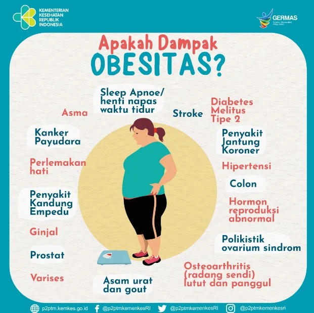 Cara Baru Mengatasi Obesitas