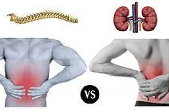 Membedakan Nyeri Punggung Akibat Aktivitas dan Masalah Ginjal
