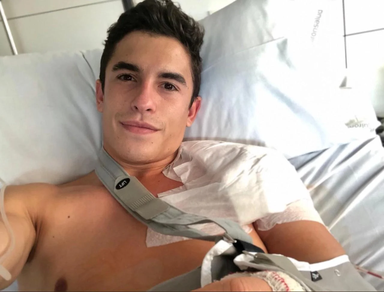 Marc Marquez Percepat Operasi Bahu Usai Cedera Kaki di Le Mans