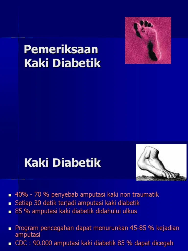 Model AI Prediksi Risiko Amputasi Kaki pada Pasien Diabetes Diperkenalkan untuk Pencegahan Dini