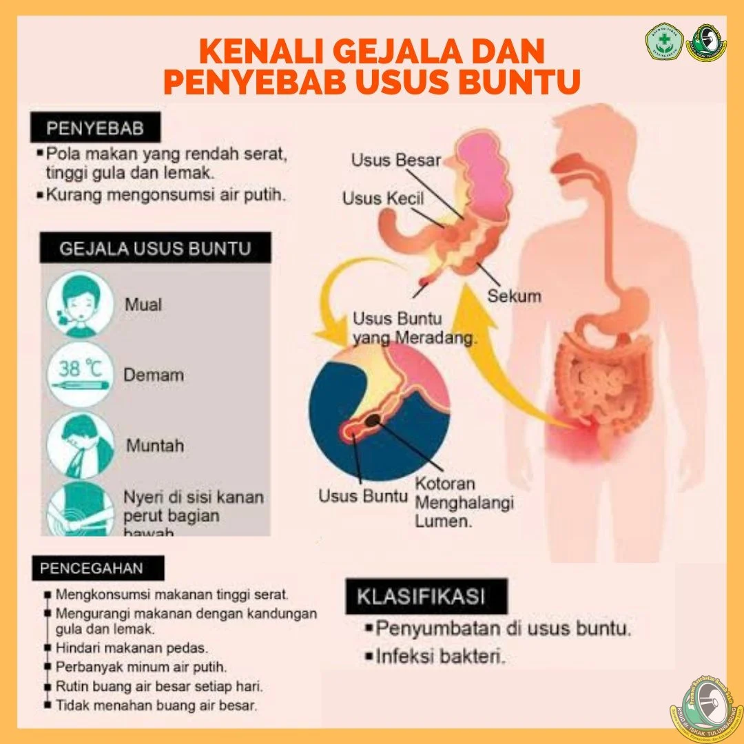 Gejala Usus Buntu yang Sering Diabaikan, Dari Nyeri Perut hingga Demam Mendadak