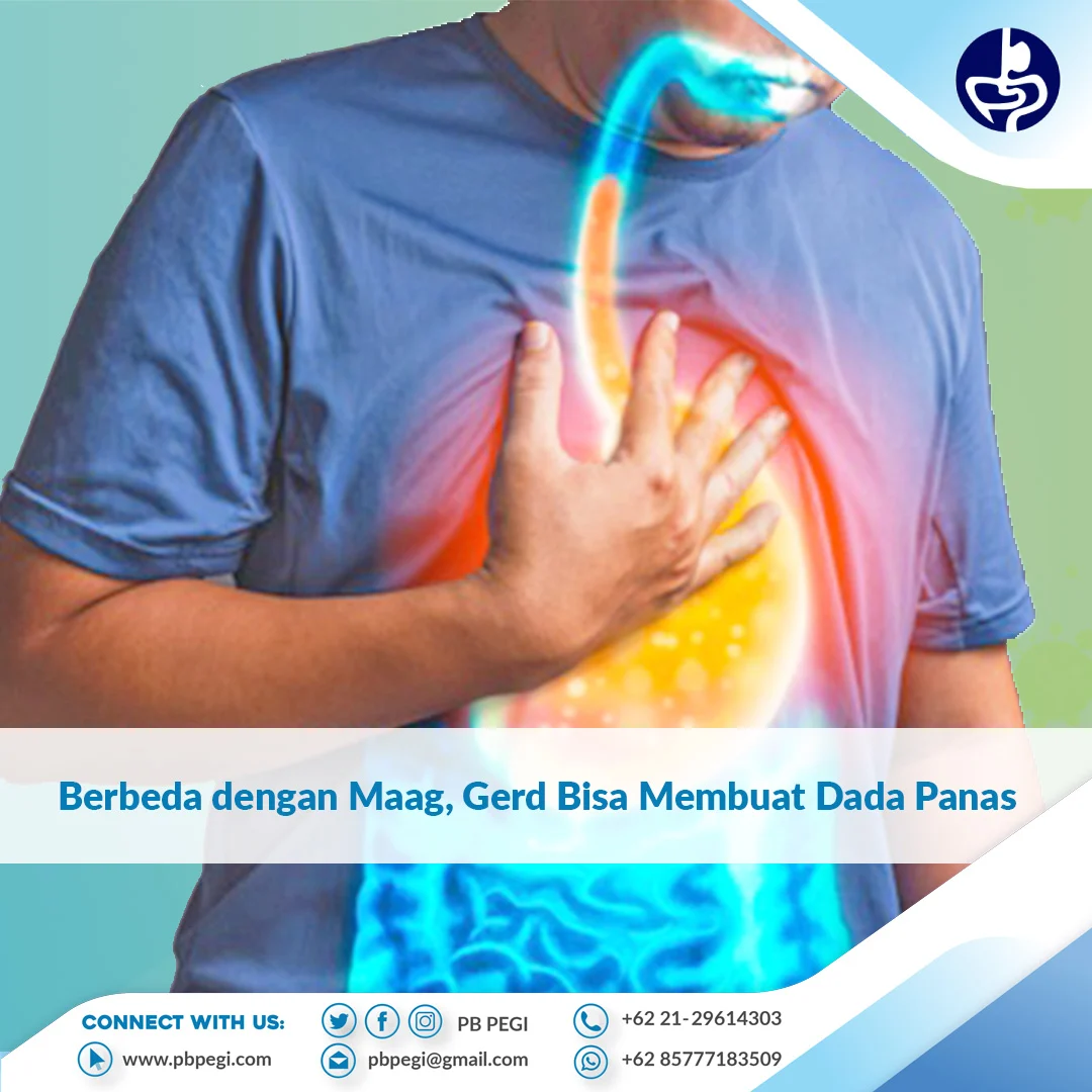 Kenapa Saat GERD Kambuh Dada Terasa Panas? Ini Penjelasan Dokter